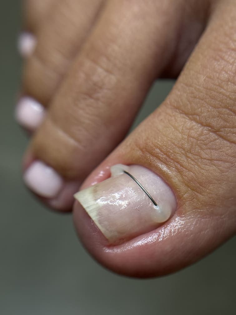 Титановая нить